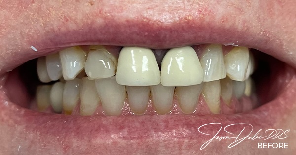 smile gallery image