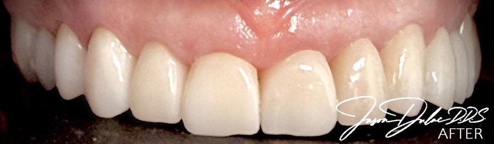 smile gallery image
