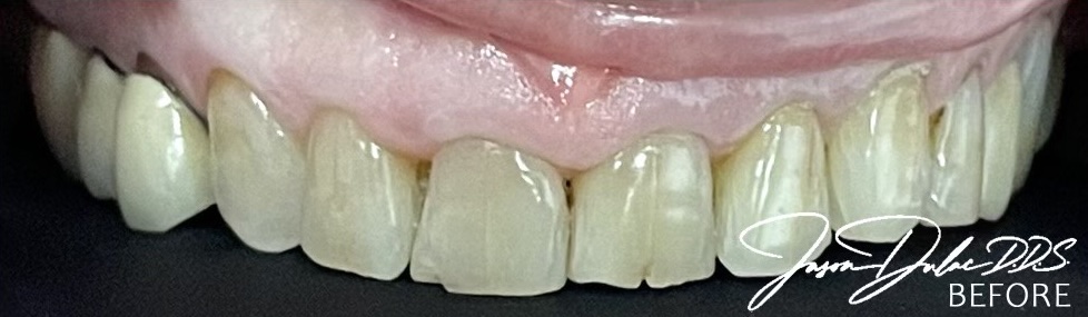 smile gallery image