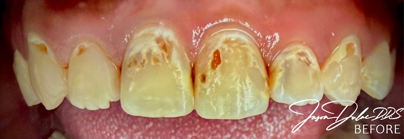 smile gallery image
